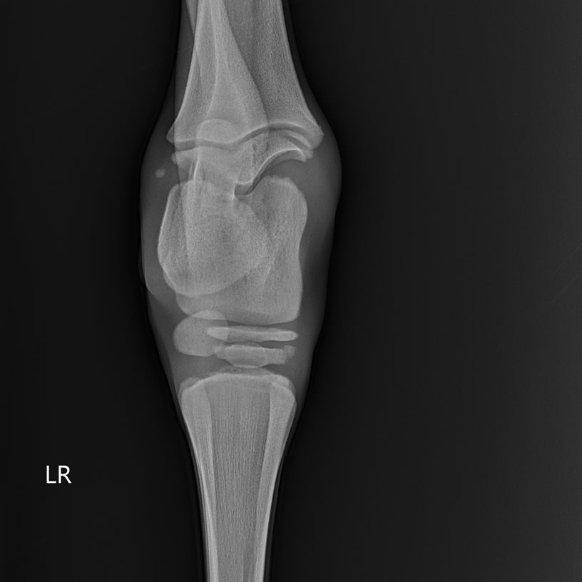 Napoleon's radiograph showing poorly formed bones.